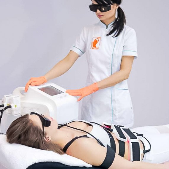 Lipolaser